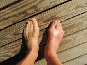The end of gout buy