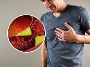 The oxidized cholesterol strategy buy